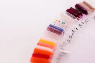 découvrez les causes des taches blanches sur les ongles, souvent liées à des carences nutritionnelles, et apprenez comment y remédier pour des ongles sains.